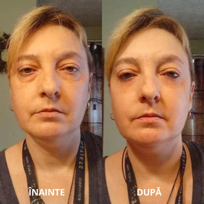 Plasturi hidrogelici sub ochi cu peptide și colagen