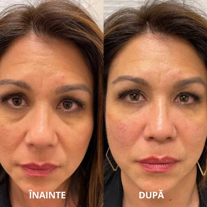 Plasturi hidrogelici sub ochi cu peptide și colagen