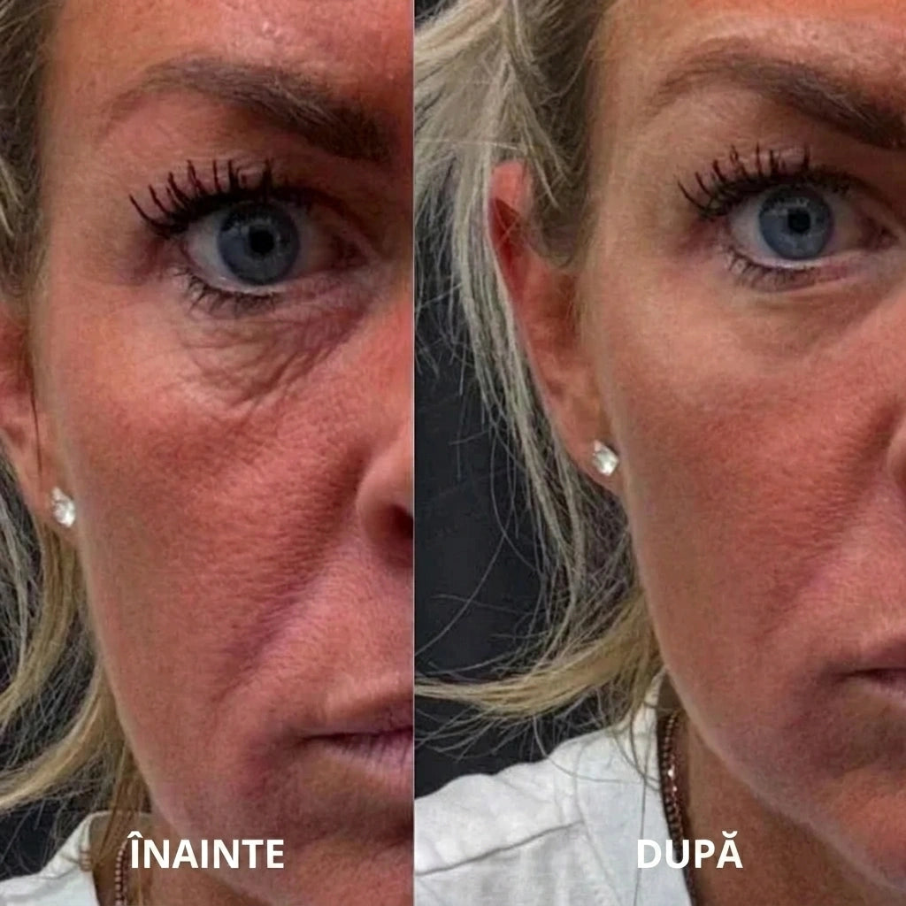 Plasturi hidrogelici sub ochi cu peptide și colagen