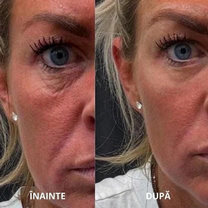 Plasturi hidrogelici sub ochi cu peptide și colagen